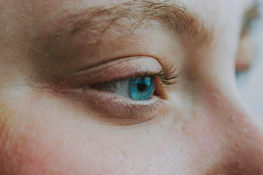 operation hypermetropie risques chirurgie refractive cataracte paris docteur camille rambaud