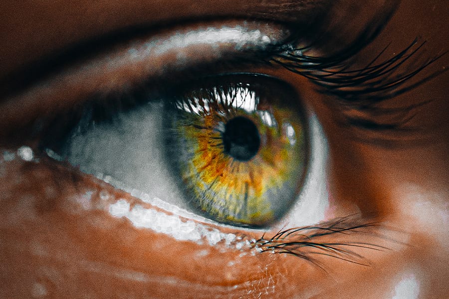 operation hypermetropie presbytie ophtalmologiste specialiste chirurgie refractive paris docteur camille rambaud