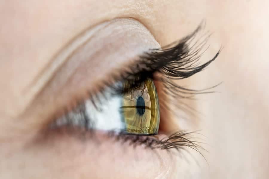 operation astigmate hypermetrope chirurgie refractive cataracte paris docteur camille rambaud